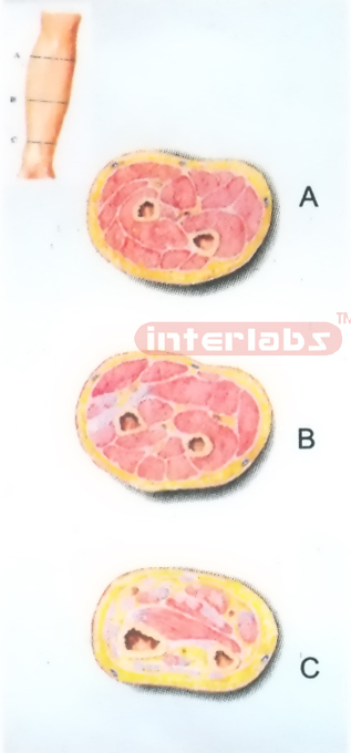 HUMAN TRANSVERSE SECTION THROUGH THE PROXIMAL 1/3 OF RIGHT FOREARM (A, B, C)